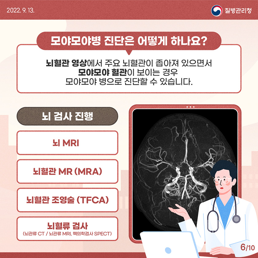 [2022년 9월 13일 질병관리청] 모야모야병 진단은 어떻게 하나요? 뇌혈관영상에서 주요 뇌혈관이 좁아져 있으면서 모야모야 혈관이 보이는 경우 모야모야 병으로 진단할 수 있습니다. 뇌MRI, 뇌혈관MR(MRA), 뇌혈관 조영술(TFCA), 뇌혈류 검사 [10페이지 중 6페이지]